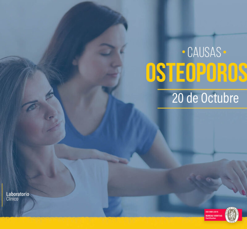 osteoporosis_mundial_neolab_laboratorio_clínico