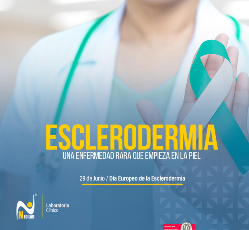 esclerodermia_neolab_laboratorio_clínico_día_mundial