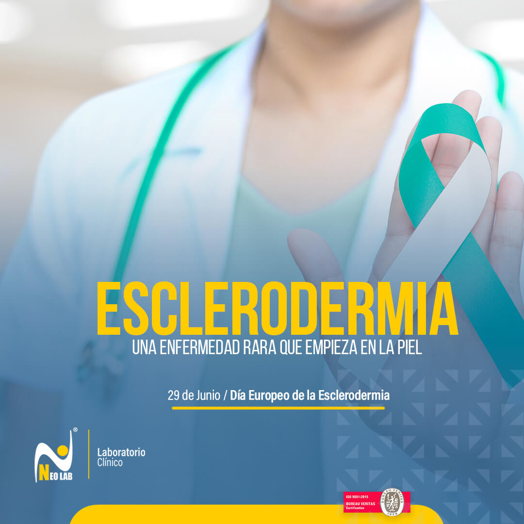 esclerodermia_neolab_laboratorio_clínico_día_mundial