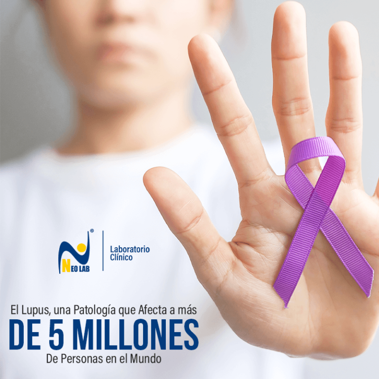 10 de Mayo Día Mundial del Lupus Neolab